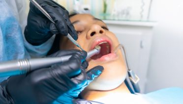filling a tooth procedure step by step dental filling procedure filling procedure dental dental fillings procedure dentist filling procedure filling tooth procedure how fillings are done how a filling is done cavity filling procedure