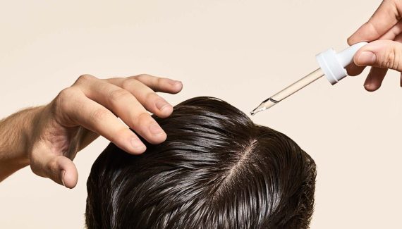 How Rogaine Prevents Hair Loss